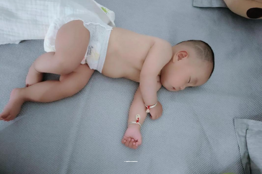 沧州六个月宝宝眼睛散光